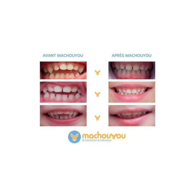MACHOUYOU 1st Teething Device - Nipple Withdrawal